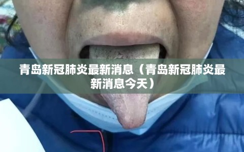 青岛新冠肺炎最新消息（青岛新冠肺炎最新消息今天）